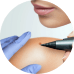 freezpen 7 NuFace Skin Care